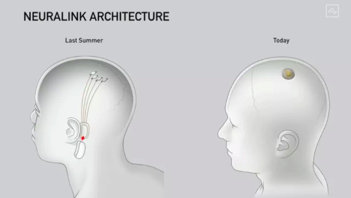 Mengenal Neuralink, Perusahaan Elon Musk Yang Bikin Chip Untuk Otak