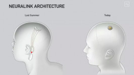 Mengenal Neuralink, Perusahaan Elon Musk yang Bikin Chip untuk Otak