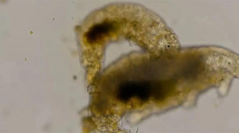 Peneliti Lihat Tardigrade Lagi Threesome