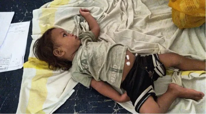 Bayi Ajaib Jadi Seleb Gegara Gigit Kobra Sampai Mati